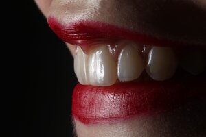Dentist FAQ: What Causes Transparent Teeth?
