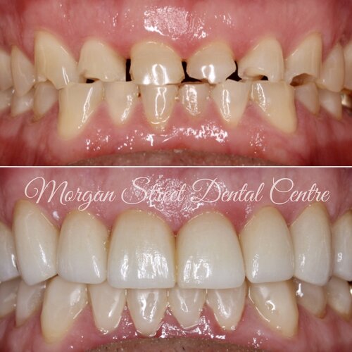 dentist+wagga+2