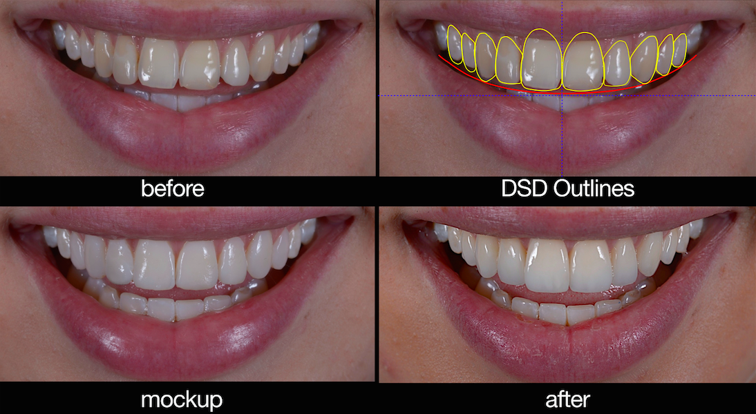 dentist+wagga+smile+design