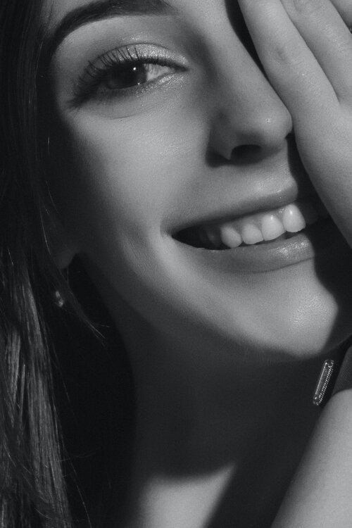 gummy+smile+wagga+dentist