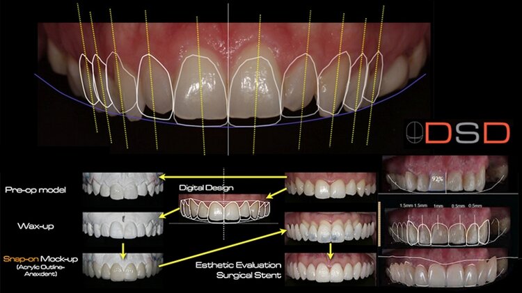 smile+design+dentist+wagga