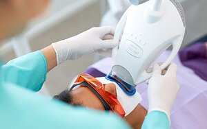 Dentist Wagga FAQ – How Does In-Chair Teeth Whitening Work?