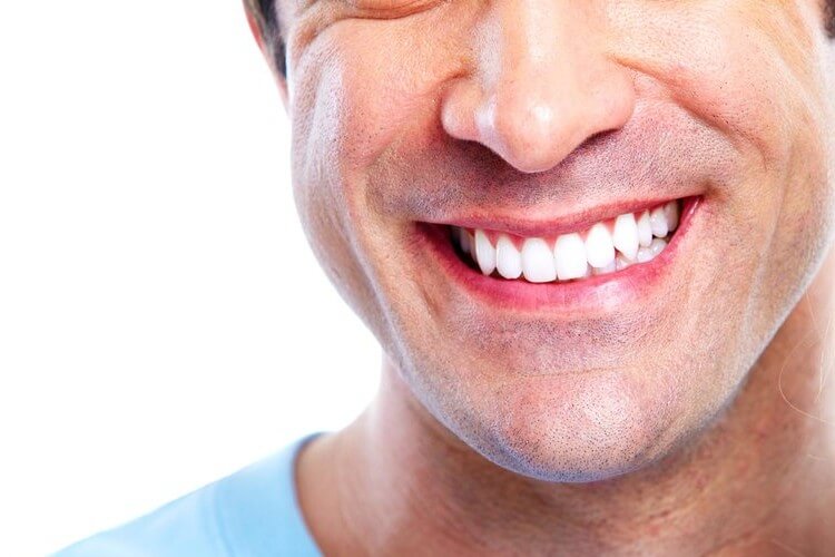 Morgan Street Dental Centre Dental Crowns - Man with Great White Teeth Smiling