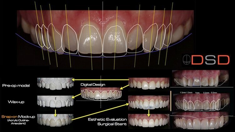 Morgan Street Dental Centre Dental Practice Technology - Digital Smile Design Computer Design Illustration 