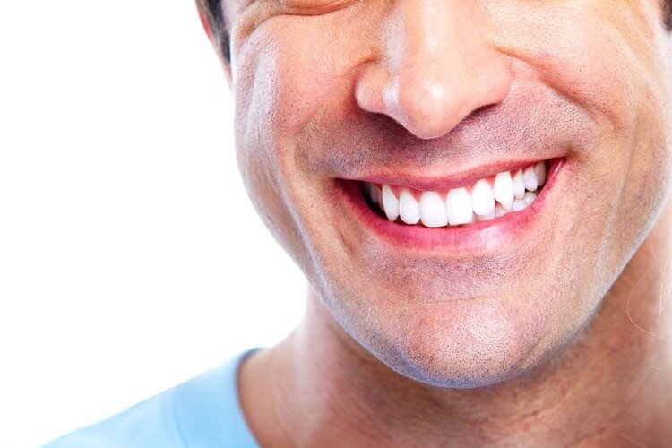 Morgan Street Dental Centre Teeth Whitening Wagga - Man with Great White Teeth Smiling 